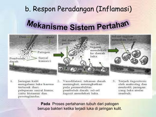 b. Respon Peradangan (Inflamasi)

Pada Proses pertahanan tubuh dari patogen
berupa bakteri ketika terjadi luka di jaringan kulit.

 