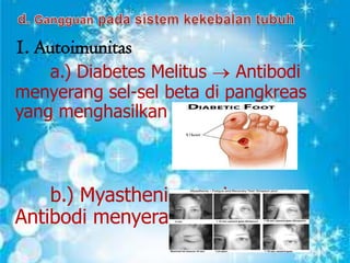 1. Autoimunitas
a.) Diabetes Melitus
Antibodi
menyerang sel-sel beta di pangkreas
yang menghasilkan hormon insulin.

b.) Myasthenia gravis
Antibodi menyerang otot lurik.

 