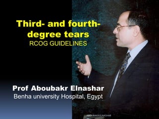 Third- and fourth-
degree tears
RCOG GUIDELINES
Prof Aboubakr Elnashar
Benha university Hospital, Egypt
ABOUBAKR ELNASHAR
 