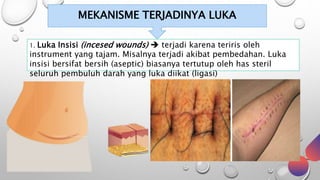 MEKANISME TERJADINYA LUKA
1. Luka Insisi (incesed wounds)  terjadi karena teriris oleh
instrument yang tajam. Misalnya terjadi akibat pembedahan. Luka
insisi bersifat bersih (aseptic) biasanya tertutup oleh has steril
seluruh pembuluh darah yang luka diikat (ligasi)
 
