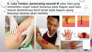 6. Luka Tembus (penetrating wound)  yaitu luka yang
menembus organ tubuh biasanya pada bagian awal luka
masuk diameternya kecil tetapi pada bagian ujung
biasanya lukanya akan melebar
 