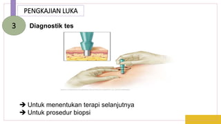 PENGKAJIAN LUKA
Diagnostik tes
3
 Untuk menentukan terapi selanjutnya
 Untuk prosedur biopsi
 