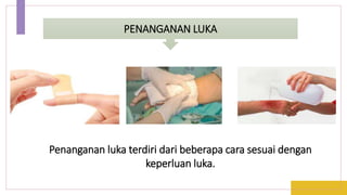 PENANGANAN LUKA
Penanganan luka terdiri dari beberapa cara sesuai dengan
keperluan luka.
 
