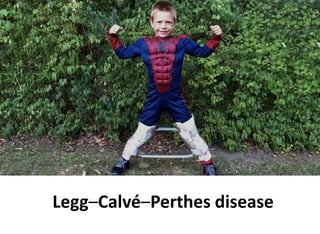 Legg–Calvé–Perthes disease
 