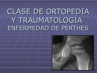 CLASE DE ORTOPEDIACLASE DE ORTOPEDIA
Y TRAUMATOLOGÍAY TRAUMATOLOGÍA
ENFERMEDAD DE PERTHESENFERMEDAD DE PERTHES
 