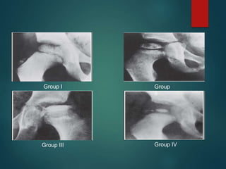 Group I Group
II
Group III Group IV
 