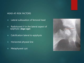 HEAD-AT-RISK FACTORS
 Lateral subluxation of femoral head
 Radiolucent V in the lateral aspect of
epiphysis (Gage sign)
 Calcification lateral to epiphysis
 Horizontal physeal line
 Metaphyseal cyst
 