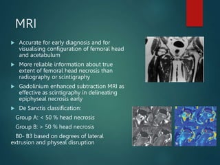 MRI
 Accurate for early diagnosis and for
visualising configuration of femoral head
and acetabulum
 More reliable information about true
extent of femoral head necrosis than
radiography or scintigraphy
 Gadolinium enhanced subtraction MRI as
effective as scintigraphy in delineating
epiphyseal necrosis early
 De Sanctis classification:
Group A: < 50 % head necrosis
Group B: > 50 % head necrosis
B0- B3 based on degrees of lateral
extrusion and physeal disruption
 