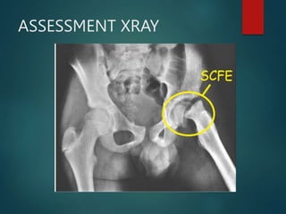 ASSESSMENT XRAY
 