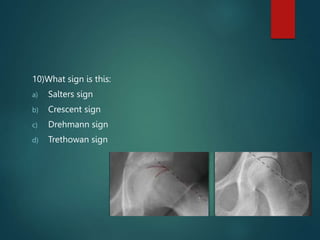 10)What sign is this:
a) Salters sign
b) Crescent sign
c) Drehmann sign
d) Trethowan sign
 
