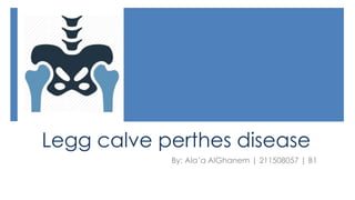 Legg calve perthes disease
By: Ala’a AlGhanem | 211508057 | B1
 