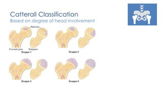 legg calve Perthes disease | PPTX