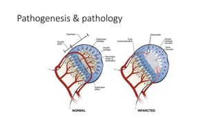 Pathogenesis & pathology
 