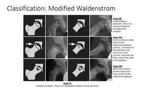 Classification: Modified Waldenstrom
 
