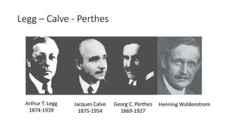 Legg – Calve - Perthes
Arthur T. Legg
1874-1939
Jacques Calve
1875-1954
Georg C. Perthes
1869-1927
Henning Waldenstrom
 