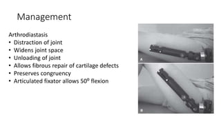 Management
Arthrodiastasis
• Distraction of joint
• Widens joint space
• Unloading of joint
• Allows fibrous repair of cartilage defects
• Preserves congruency
• Articulated fixator allows 50⁰ flexion
 