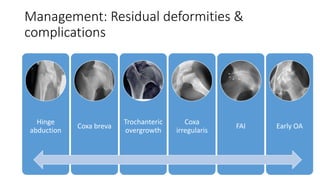Management: Residual deformities &
complications
Hinge
abduction
Coxa breva
Trochanteric
overgrowth
Coxa
irregularis
FAI Early OA
 