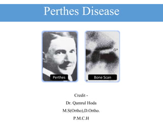Perthes Disease
Credit -
Dr. Qamrul Hoda
M.S(Ortho),D.Ortho.
P.M.C.H
Perthes Bone Scan
 