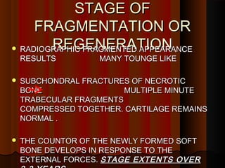 Perthes Disease.pdf perthes disease detail ppt | PDF