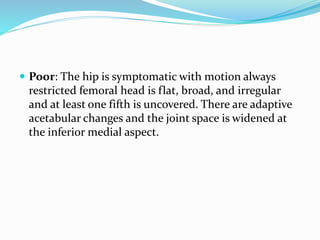  Poor: The hip is symptomatic with motion always
restricted femoral head is flat, broad, and irregular
and at least one fifth is uncovered. There are adaptive
acetabular changes and the joint space is widened at
the inferior medial aspect.
 