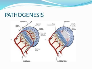 PATHOGENESIS
 