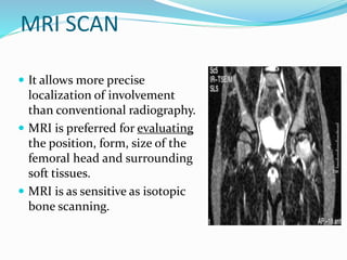 MRI SCAN
 It allows more precise
localization of involvement
than conventional radiography.
 MRI is preferred for evaluating
the position, form, size of the
femoral head and surrounding
soft tissues.
 MRI is as sensitive as isotopic
bone scanning.
 