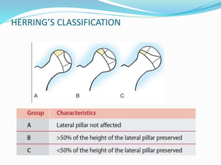 HERRING’S CLASSIFICATION
 