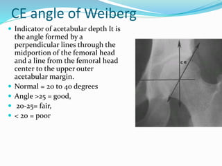 CE angle of Weiberg
 Indicator of acetabular depth It is
the angle formed by a
perpendicular lines through the
midportion of the femoral head
and a line from the femoral head
center to the upper outer
acetabular margin.
 Normal = 20 to 40 degrees
 Angle >25 = good,
 20-25= fair,
 < 20 = poor
 
