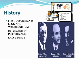 History
 FIRST DESCRIBED BY
LEGG AND
WALDENSTORM
IN 1909 AND BY
PERTHES AND
CALVE IN 1910
 