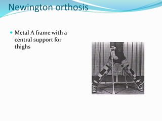 Newington orthosis
 Metal A frame with a
central support for
thighs
 