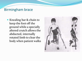 Birmingham brace
 Knealing bar & chain to
keep the foot off the
ground while a specially
altered crutch allows the
abducted, internally
rotated limb to clear the
body when patient walks
 