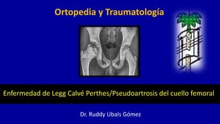 Enfermedad de Legg Calvé Perthes/Pseudoartrosis del cuello femoral
Dr. Ruddy Ubals Gómez
Ortopedia y Traumatología
 