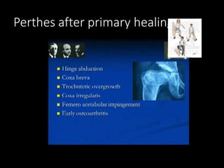 Perthes after primary healing……
 