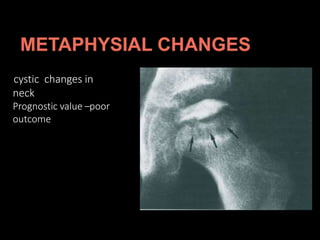 cystic changes in
neck
Prognostic value –poor
outcome
 