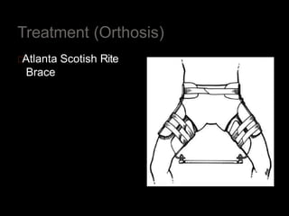 Treatment (Orthosis)
Atlanta Scotish Rite
Brace
 