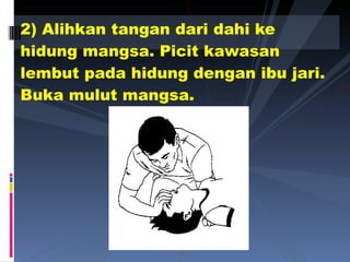 2) Alihkan tangan dari dahi ke hidung mangsa. Picit kawasan lembut pada hidung dengan ibu jari. Buka mulut mangsa. 