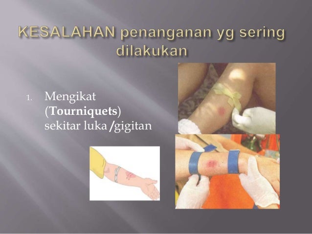 Pertolongan pertama pada gigitan ular