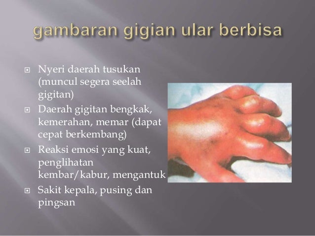 Pertolongan pertama pada gigitan ular Pertolongan pertama pada gigitan ular