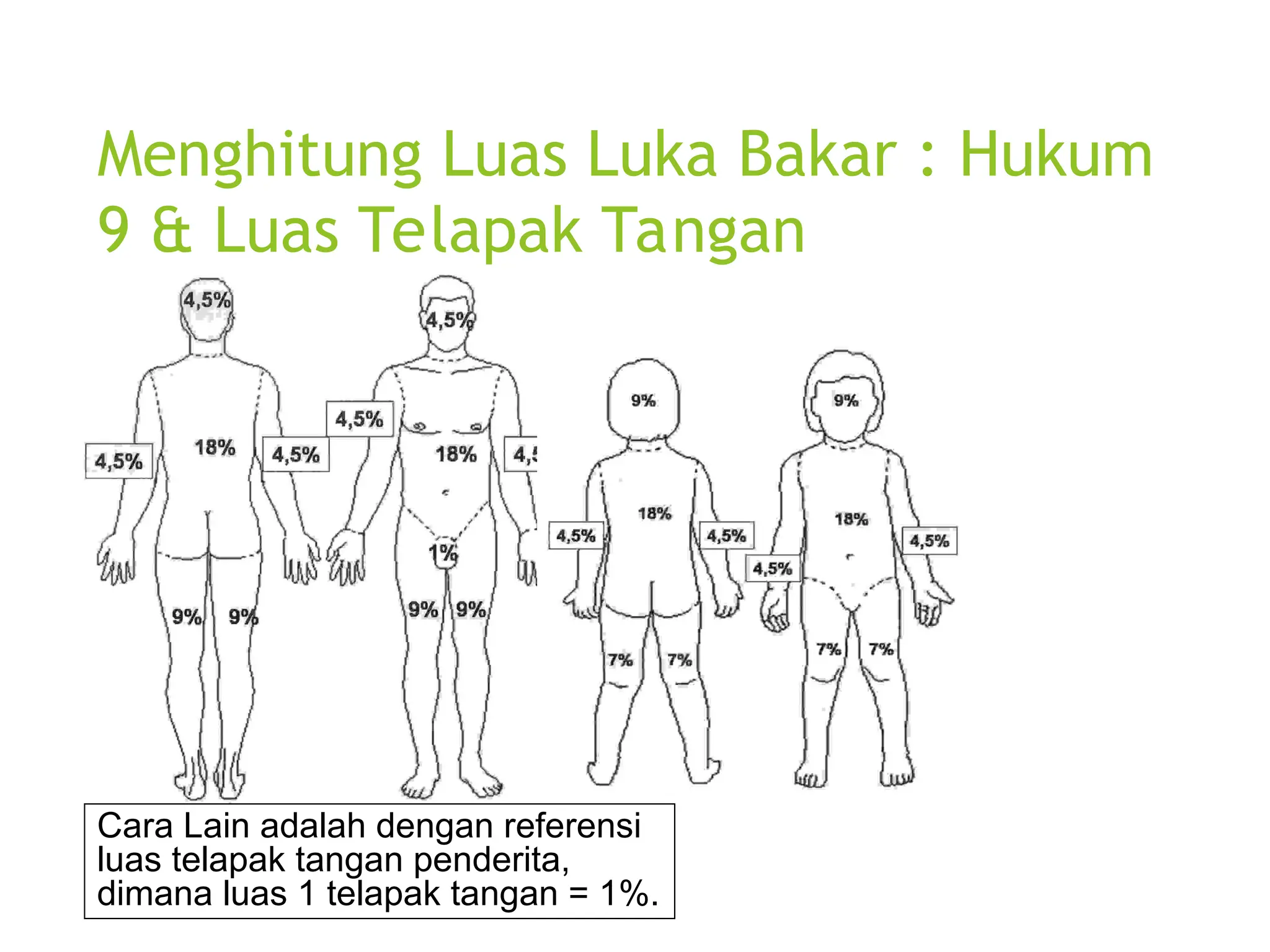 Menghitung Luas Luka Bakar : Hukum
9 & Luas Telapak Tangan
Cara Lain adalah dengan referensi
luas telapak tangan penderita,
dimana luas 1 telapak tangan = 1%.
 