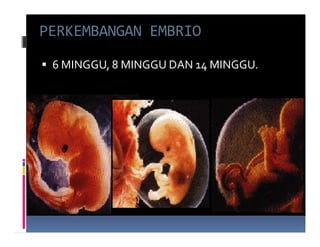 PERKEMBANGAN EMBRIO

 6 MINGGU, 8 MINGGU DAN 14 MINGGU.
 