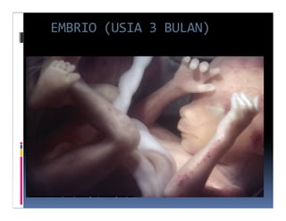 EMBRIO (USIA 3 BULAN)
 
