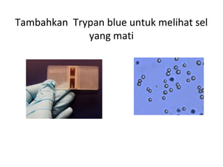 Tambahkan Trypan blue untuk melihat sel
yang mati
 