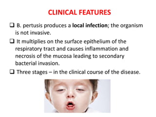 CLINICAL FEATURES
 B. pertusis produces a local infection; the organism
is not invasive.
 It multiplies on the surface epithelium of the
respiratory tract and causes inflammation and
necrosis of the mucosa leading to secondary
bacterial invasion.
 Three stages – in the clinical course of the disease.
 