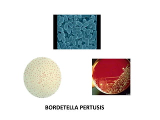 BORDETELLA PERTUSIS
 