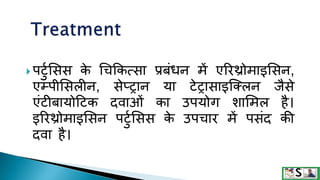  पटटुसिि क
े धचक्रकत्िा प्रबंिन में एररथ्रोमाइसिन,
एम्पीसिलीन, िेप्रान या टेरािाइक्क्लन जैिे
एंटीबायोदटक दवाओं का उपयोग िासमल है।
इररथ्रोमाइसिन पटटुसिि क
े उपचार में पिंद की
दवा है।
 