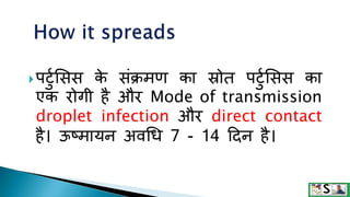 पटटुसिि क
े िंक्रमण का स्रोत पटटुसिि का
एक रोगी है और Mode of transmission
droplet infection और direct contact
है। ऊष्मायन अवधि 7 - 14 ददन है।
 