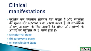  पटटुसिि एक स्थानीय िंक्रमण पैदा करता है और म्यूकोिा
की िूजन और Necrosis का कारण बनता है जो माध्यसमक
जीवाणट आक्रमण क
े सलए अग्रणी है। िंक
े त और लक्षणों क
े
आिार पर पटटुसिि क
े 3 चरण होते हैं-
 (a) catarrhal stage
 (b) paroxysmal stage
 (c) convalescent stage
 