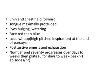 Protuded Chest Pertussis | PPTX