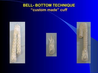 BELL- BOTTOM TECHNIQUEBELL- BOTTOM TECHNIQUE
“custom made” cuff“custom made” cuff
 