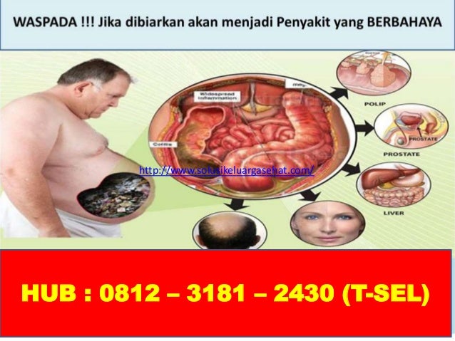 Cara Mengatasi Perut Begah Karena Kekenyangan